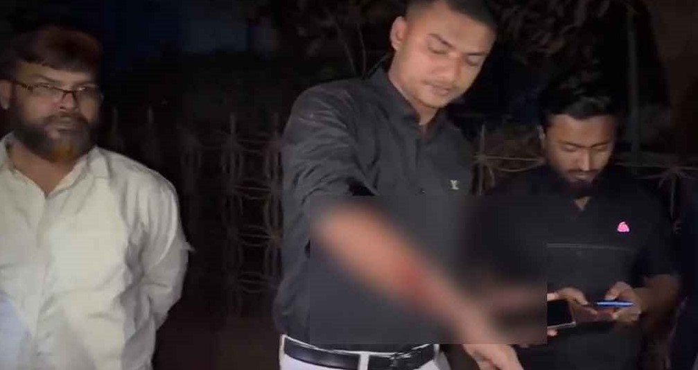 এবার গাজীপুরে বৈষম্যবিরোধী ছাত্র আন্দোলনের কর্মীকে গুলি