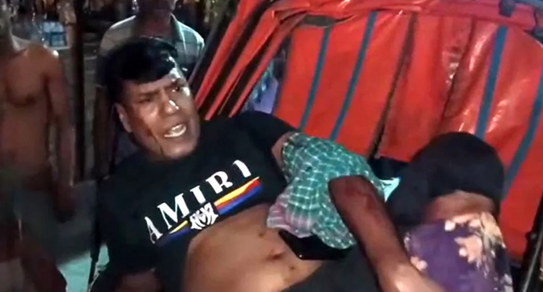 রাজশাহীতে আওয়ামী লীগ নেতাকে কুপিয়ে জখম, পরে গুলি
