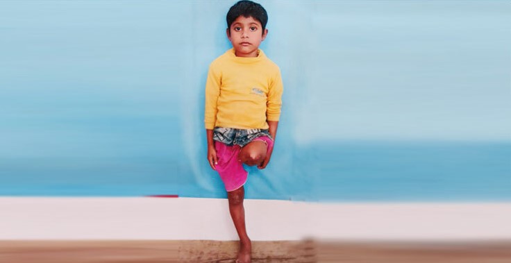 দুই লাখ টাকা হলেই বেঁচে যাবে নাটোরের মোবাশ্বীর