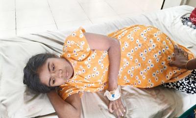 শিশুদের পাশাপাশি বড়রাও আক্রান্ত হচ্ছেন হামে